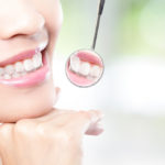 Kompleksowe leczenie stomatologiczne – odkryj ścieżkę do zdrowej i pięknego uśmiechu.